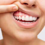 Dantenų sveikata: Apsaugokite savo šypseną nuo dantenų recesijos